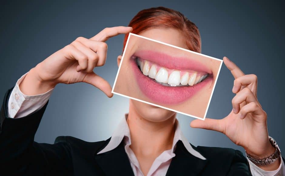 Combien coûte vraiment un blanchiment dentaire fait par le dentiste, soi même ou dans un bar à sourire?