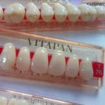 Un échantillon de prothèses dentaires