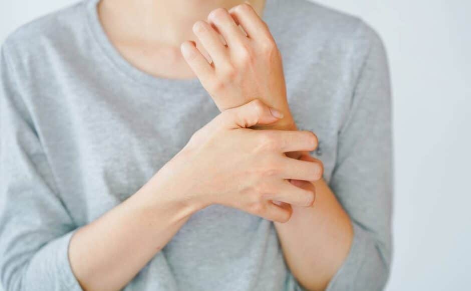 Comment soulager le psoriasis ?